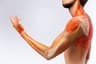 Nerve Pain