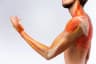 Nerve Pain